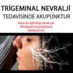 00_Trigeminal-Nevralji